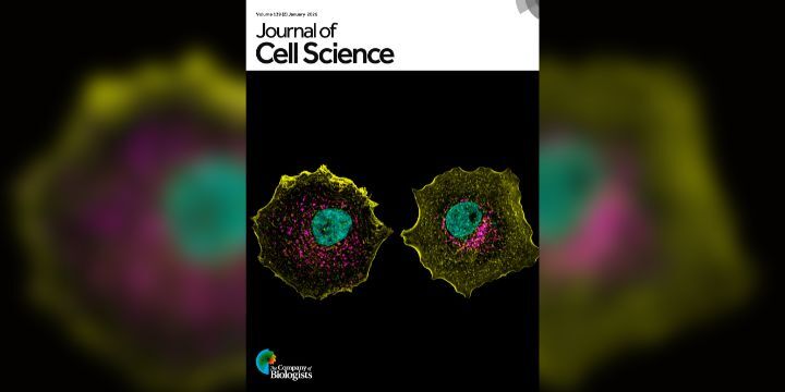 A photo of the cover page showing two cancer cells where the cell boundary, nucleus and goldi are labeled with different colors